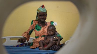 Salah satu anak Nigeria yang menderita malnutrisi akut. Foto: Abba Adamu Musa/MSF