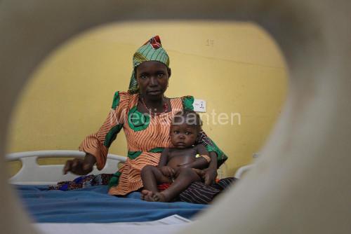 Salah satu anak Nigeria yang menderita malnutrisi akut. Foto: Abba Adamu Musa/MSF