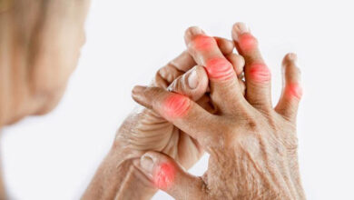 Penyakit Asam Urat. Foto: Istimewa