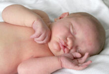 Ilustrasi Bayi Cacat Sumbing. Foto: ISctock