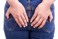 ilustrasi penyakit fisura aini.