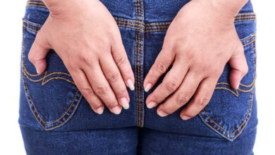 ilustrasi penyakit fisura aini.