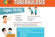 pamflet gejala TBC. Foto: Dinkes Banten