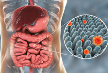 Virus Hepatitis B jadi penyebab utama kanker. Foto: Halodocter