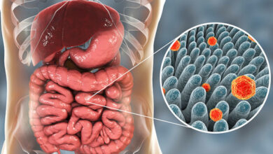 Virus Hepatitis B jadi penyebab utama kanker. Foto: Halodocter