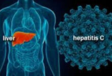 Ilustrasi penyakit Hepatitis C Aktif. Foto: Istimewa