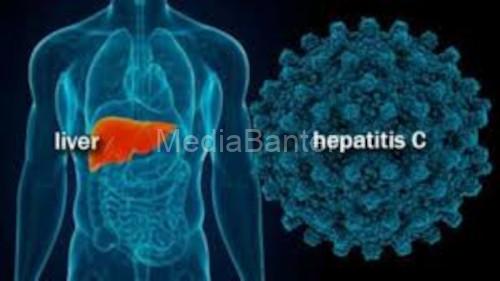 Ilustrasi penyakit Hepatitis C Aktif. Foto: Istimewa