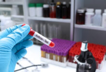 Penyakit Antraks. Foto: Istockphoto