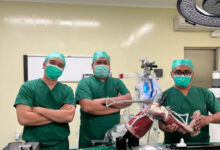 Ganti lutut robotik di RS. Foto: Antara