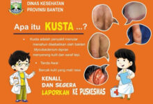 Pamflet Penyakit Kusta. Foto: Dinkes Banten