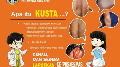 Pamflet Penyakit Kusta. Foto: Dinkes Banten