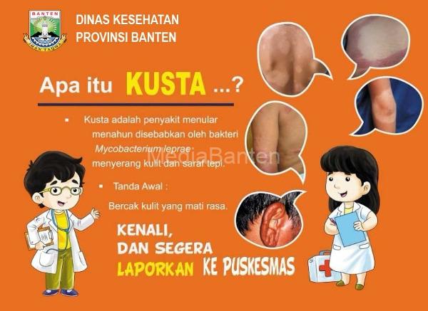 Dinkes Banten Ajak Hapuskan Stigma dan Diskrimindasi Kusta ...
