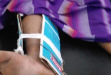 Warga Baduy korban gigitan ular tanah. Foto: Antara