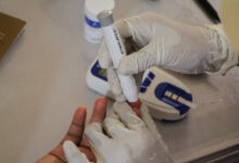 Pemeriksaan diabetes melliteus atau gula darah. Foto: Antara