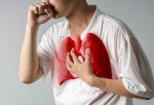 Ilustrasi penyakit TBC atau tuberkulosis. Foto Istimewa