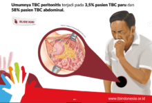 Penyakit Tuberkuloasi atau TBC. Foto: TbIndonesia