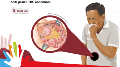 Penyakit Tuberkuloasi atau TBC. Foto: TbIndonesia