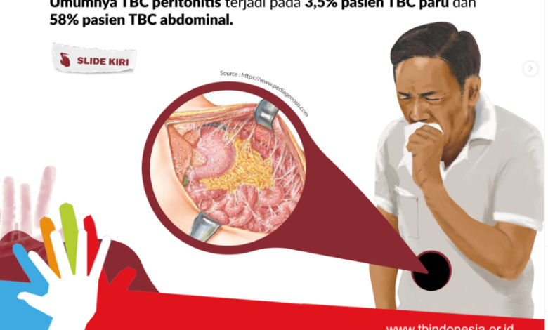 Penyakit Tuberkuloasi atau TBC. Foto: TbIndonesia