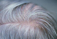 Rambut putih atau uban. Foto: Istimewa