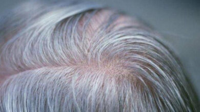 Rambut putih atau uban. Foto: Istimewa