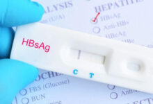 Alat tes antigen Hepatitis B. Foto: Istimewa