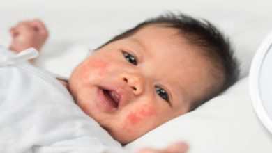 Penyakit sepsis pada anak atau balita. Foto: LKBN Antara